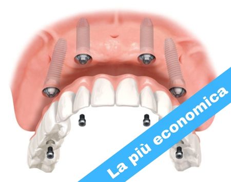 BASIC<br>Full-arch (singola arcata)